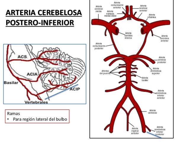 arteria cerebelosa posteroinferior